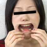 歯、痛いですか？ 素人娘たちの意識調査 【haisetsu-0146】